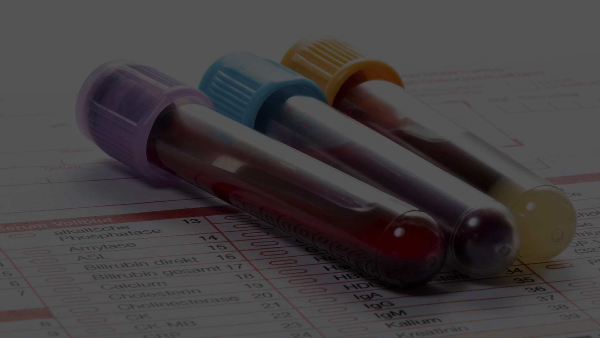 ΑΙΜΑΤΟΛΟΓΙΚΕΣ ΕΞΕΤΑΣΕΙΣ